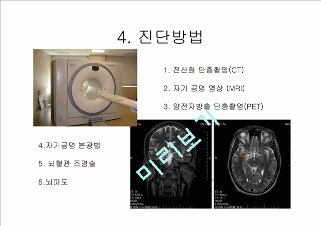 [4000원] 뇌종양종류 및 증상,양성종양 VS 악성종양,뇌종양 수술 방법,뇌종양에 좋은 음식,뇌농양,두부손상,두부손상 응급처치,두부손상에 의한 질환.pptx